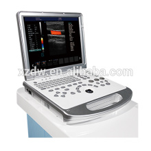 best ultrasound machine& portable ultrasound machines for sale DW-C60 Plus